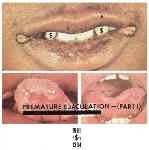 premature ejaculation (rozz williams) - part 1 premature ejaculation (rozz williams) - part 1