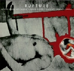 nurse with wound - graham bowers - rupture nurse with wound - graham bowers - rupture