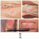 premature ejaculation (rozz williams) - part 2