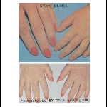 Sick Llama – Surrounded By Gold And Dead