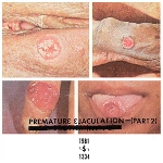 Premature Ejaculation (Rozz Williams) – Part 2