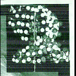 Smegma & L'autopsie A Révélé Que La Mort Était Due A L'autopsie – Transmissions Des Fluides