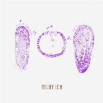 Hydromedusae – Hydromedusae