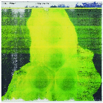 Z.b. Aids – For Franz